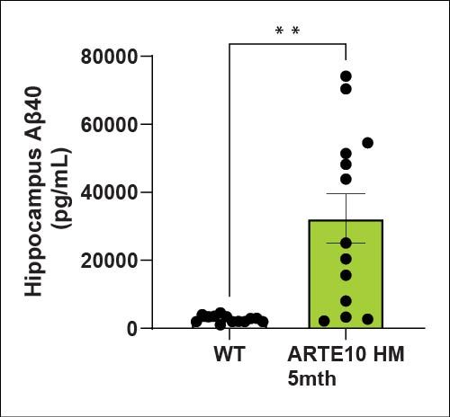 Hippocampus Aβ40
