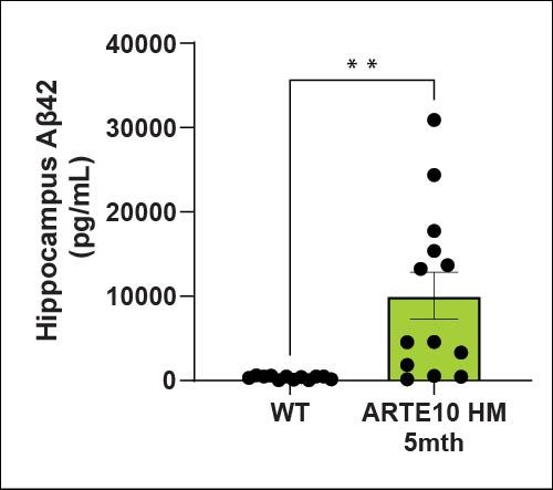 Hippocampus Aβ42